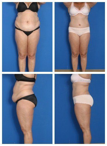 composite_16039700342957