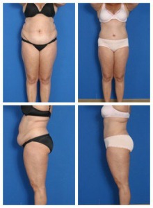 composite_16039700342957