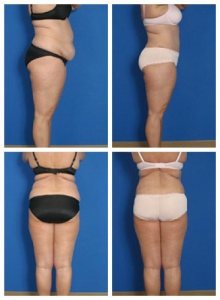 composite_16039700783908