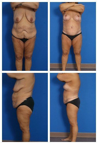 composite_16039612256038