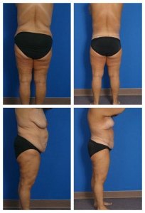 composite_16039612833764