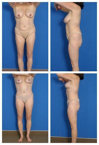 composite_16039586849000