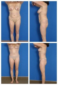 composite_16039586849000