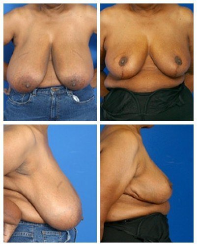 composite_16039633811488