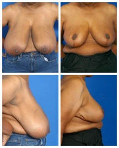 Case 1