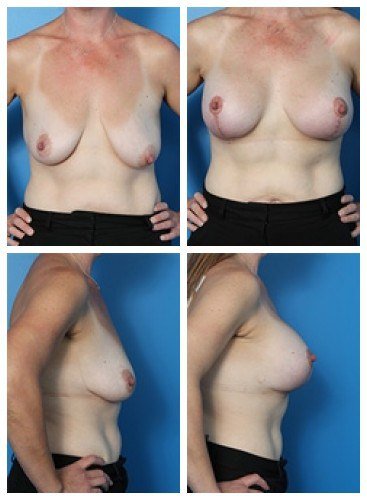 composite_16039778448325