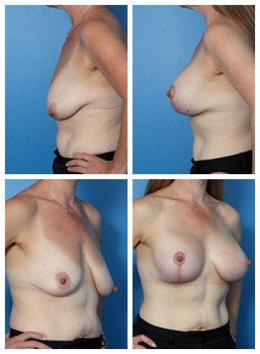 composite_16039778981873