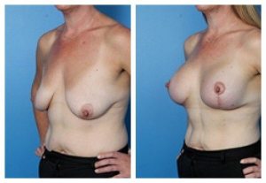 composite_16039779328263