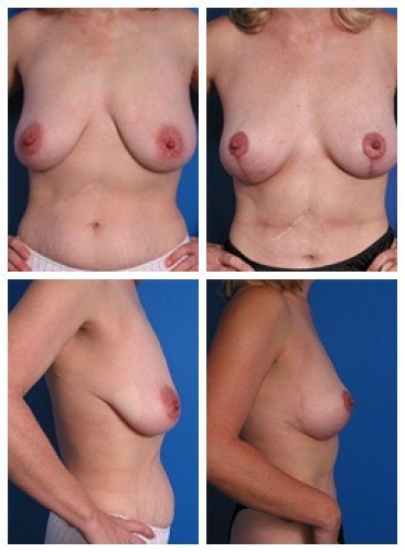 composite_16039787368948