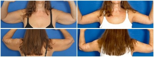 composite_16039698217844