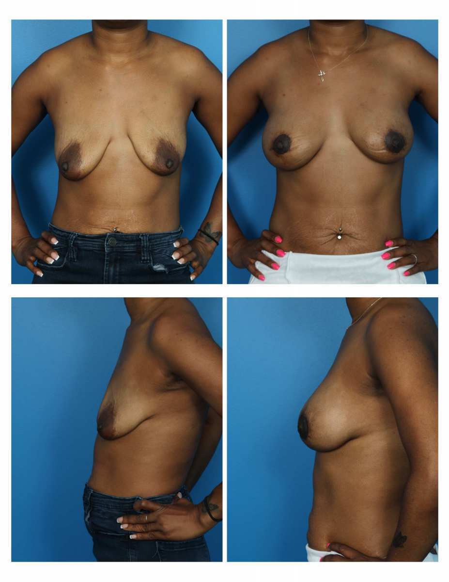 93f96d29-2a59-451d-b55e-ccb7489f4a24-0