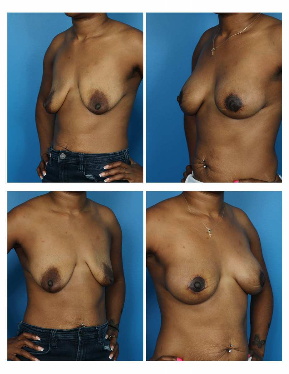 93f96d29-2a59-451d-b55e-ccb7489f4a24-1