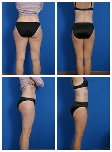 composite_16039621068928