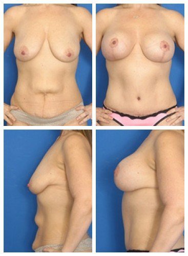 composite_16039603278369