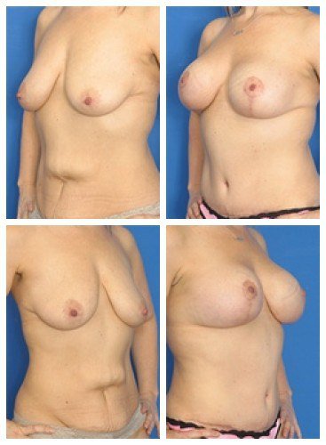 composite_16039603745977