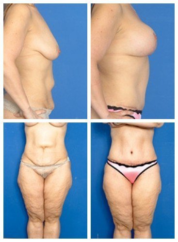 composite_16039604024413