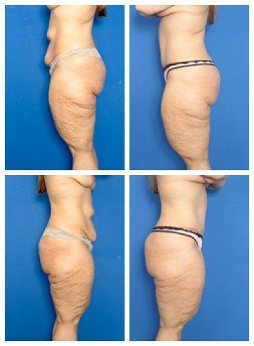 composite_16039604443727