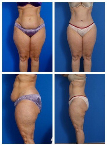 composite_16039705956471