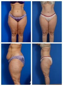 composite_16039705956471