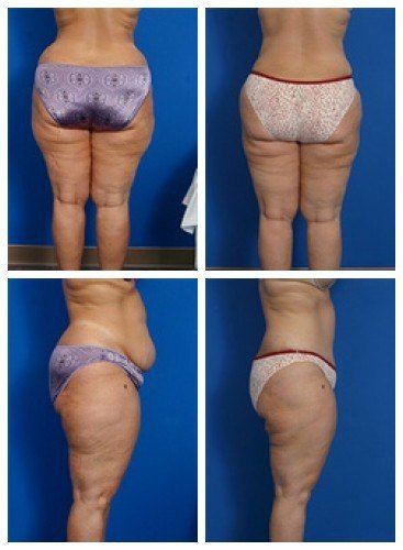 composite_16039706262712