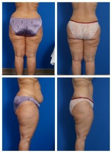 composite_16039706262712