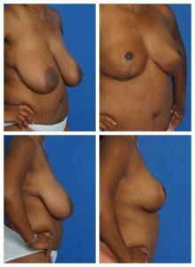 composite_16039605157326