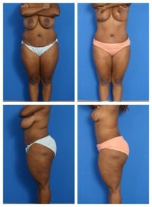 composite_16039605449332