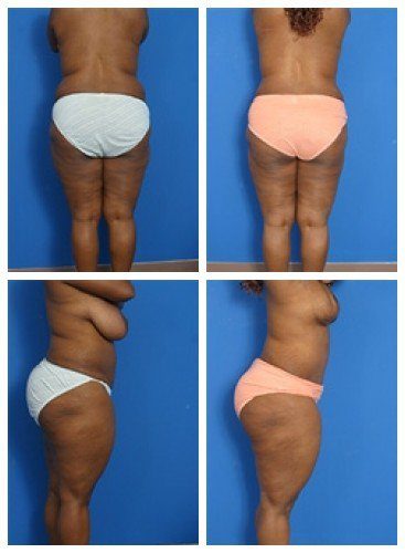 composite_16039605717415