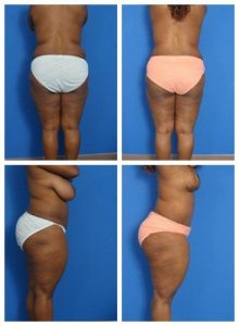 composite_16039605717415