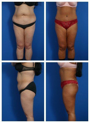 composite_16039706545232