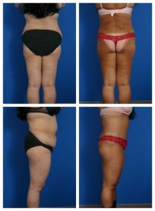 composite_16039706864643