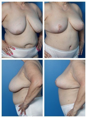 composite_16039606681171