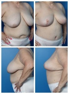 composite_16039606681171