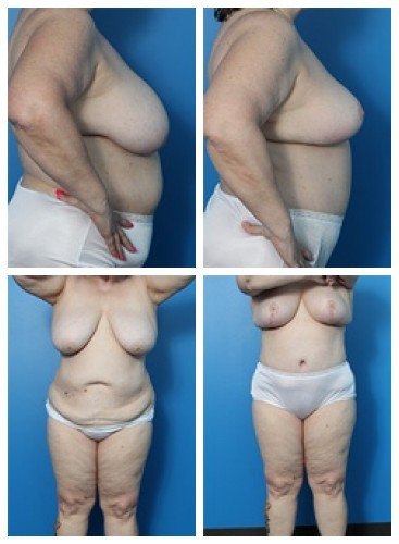 composite_16039606965669