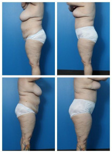 composite_16039607221755