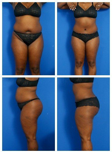 composite_16039707961279