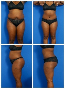 composite_16039707961279