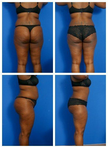 composite_16039708307998