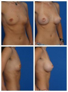 composite_16040470262392