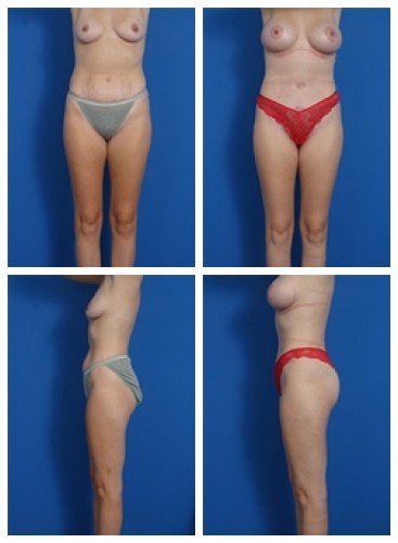 composite_16039607584107