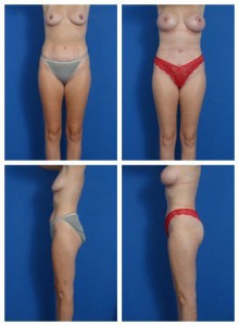 composite_16039607584107