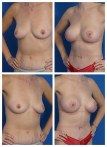 composite_16039608154101