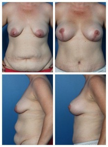 composite_16039608557902