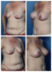 composite_16039608926162