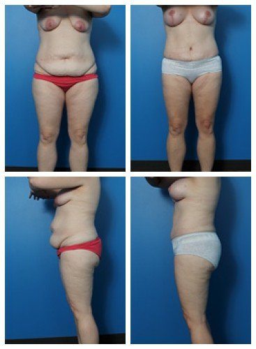 composite_16039609164957