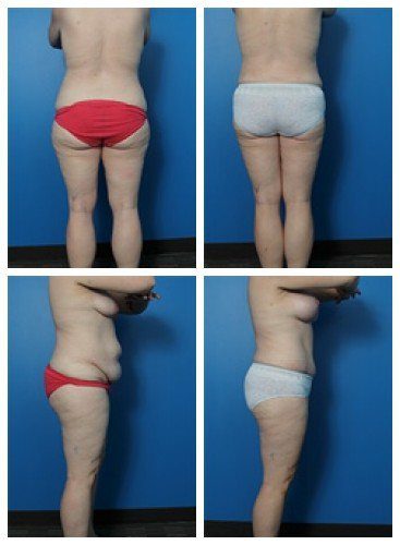 composite_16039609416499