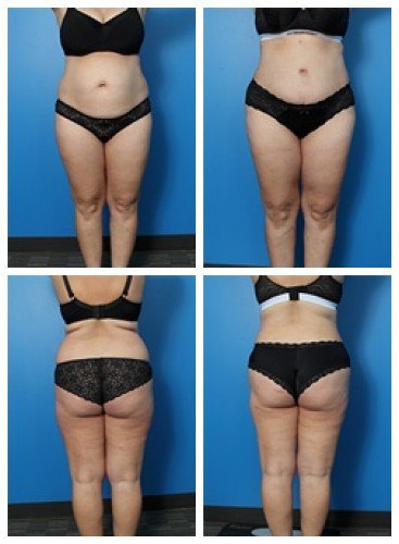 composite_16039610106099