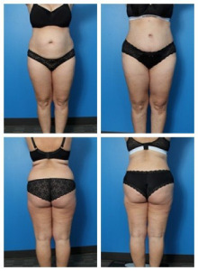 composite_16039610106099