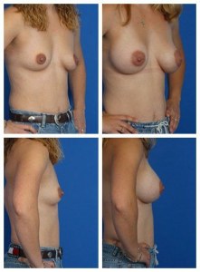 composite_16040472034608