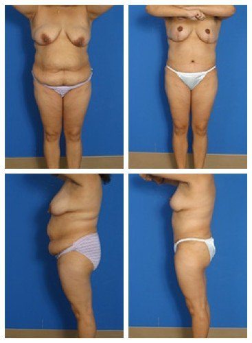 composite_16039610391087